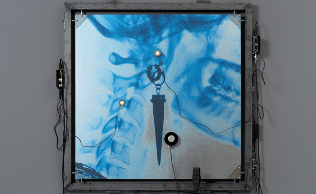 Lorde: Ultrasound Tour