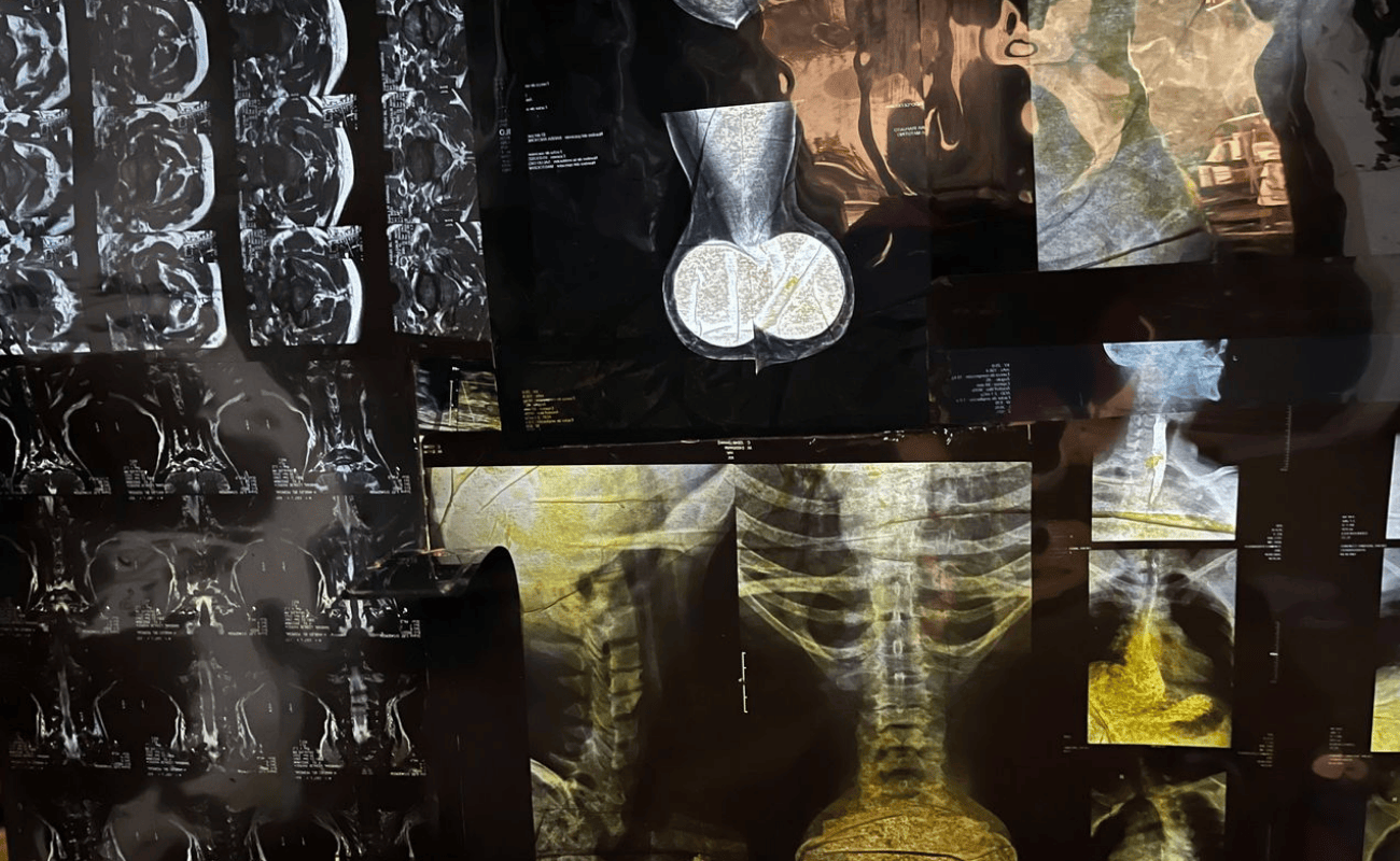 Autoradiográficas: el cuerpo interior